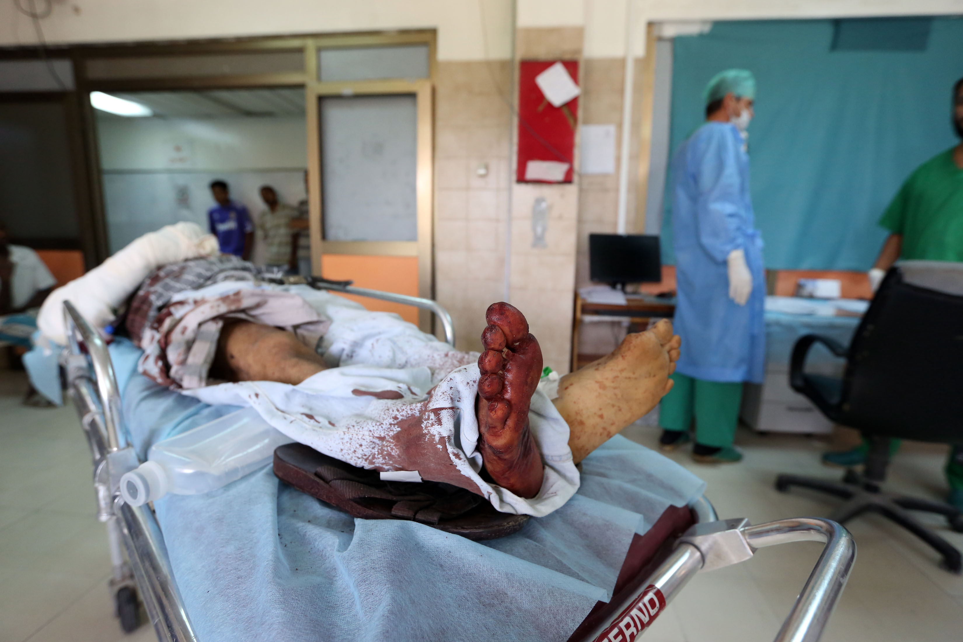 A 54 year old Tunisian citizen, identified as Mohammed bin Amer bin Saleh, receives treatment for serious wounds he sustained when a carbomb blew up in central Tripoli on 4 August. Gunbattles between youth allegedly competing for market place and a car blast sent a shudder through the Libyan capital, residents and security sources said, adding on person was wounded AFP PHOTO / MAHMUD TURKIA