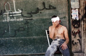 Syrian man wounded by shelling sits on a chair outside a closed shop in the Al-Muasalat area in Aleppo AFP PHOTO/ACHILLEAS ZAVALLIS