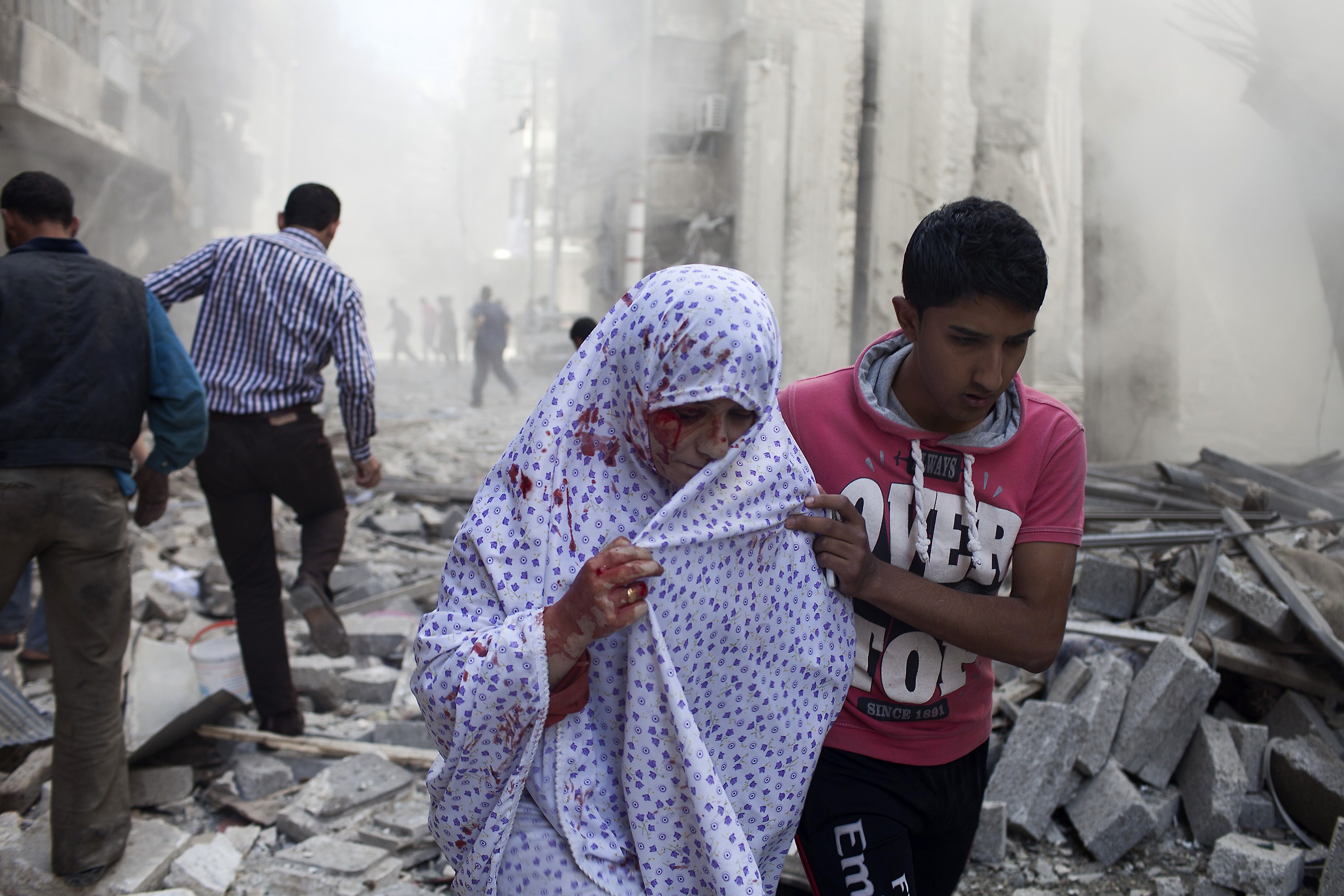 A Syrian woman is evacuated after being wounded in shelling by Assad regime forces. AFP Photo/Fabio Buccarielli