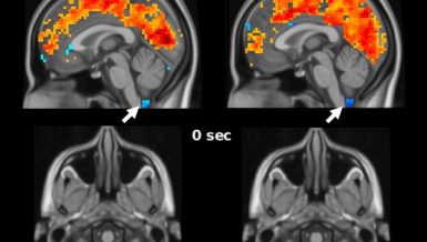 Sleep-related brain activity plays role in clearing toxic proteins, preventing Alzheimer's